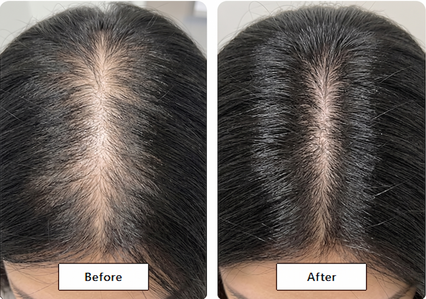Clarté™ Restoration Oil